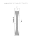 VASCULAR STENTING FOR ANEURYSMS diagram and image