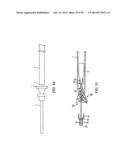 VASCULAR STENTING FOR ANEURYSMS diagram and image