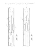 VASCULAR STENTING FOR ANEURYSMS diagram and image