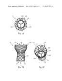 Transcatheter Prosthetic Heart Valve Delivery System and Method with     Controlled Expansion of Prosthetic Heart Valve diagram and image