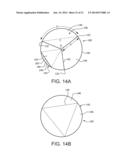 PROSTHETIC HEART VALVE WITH LEAFLET SHELVING diagram and image