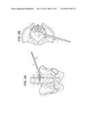 Polyaxial Articulating Instrument diagram and image