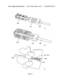 INTERVERTEBRAL SCAFFOLDING SYSTEM diagram and image