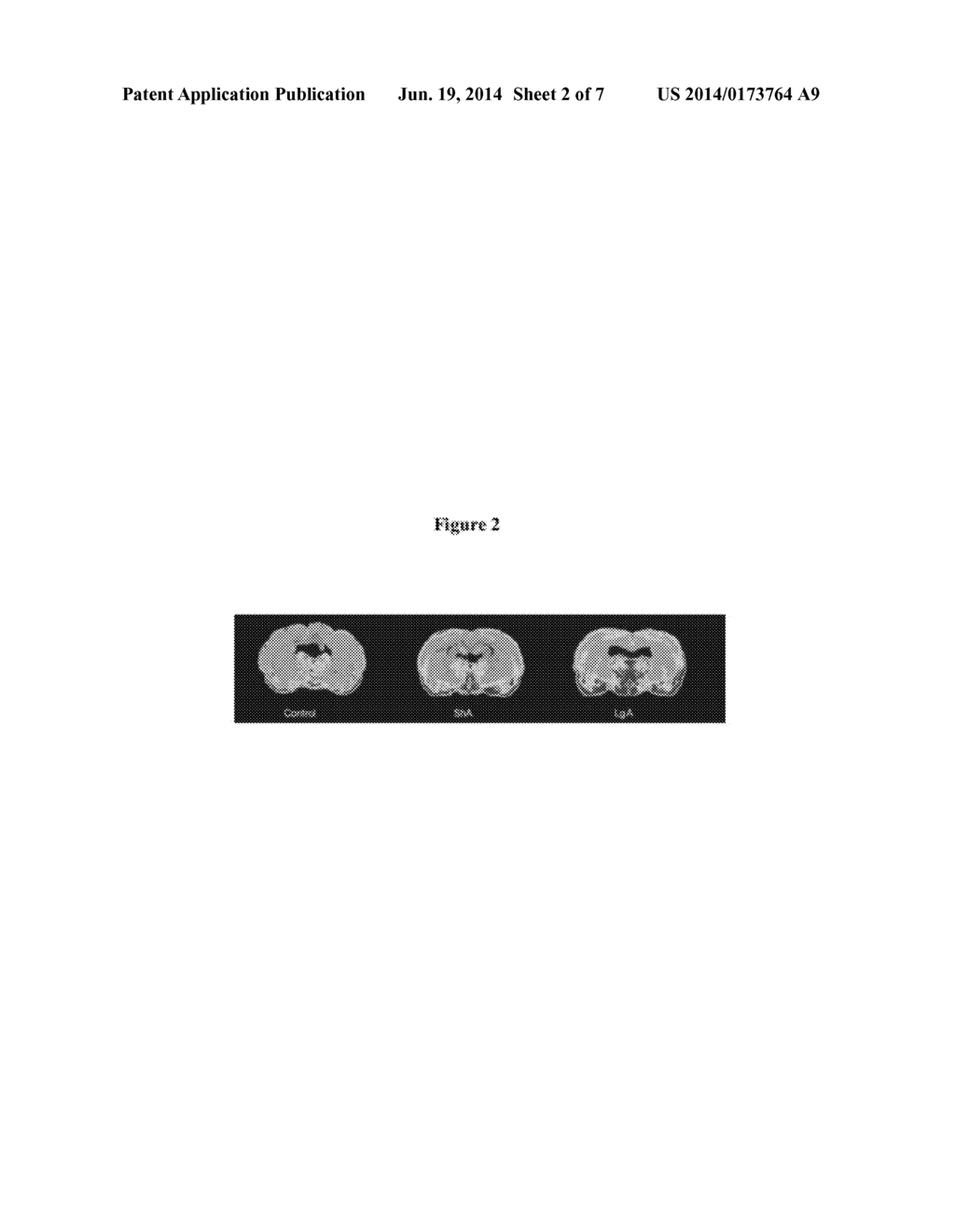 ROLE OF PROTEOGLYCANS IN DRUG DEPENDENCE - diagram, schematic, and image 03