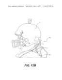 CERVICAL SPINE PROTECTION APPARATUS AND METHODS OF USE diagram and image