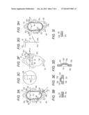 EXHAUST TREATMENT APPARATUS FOR ENGINE diagram and image