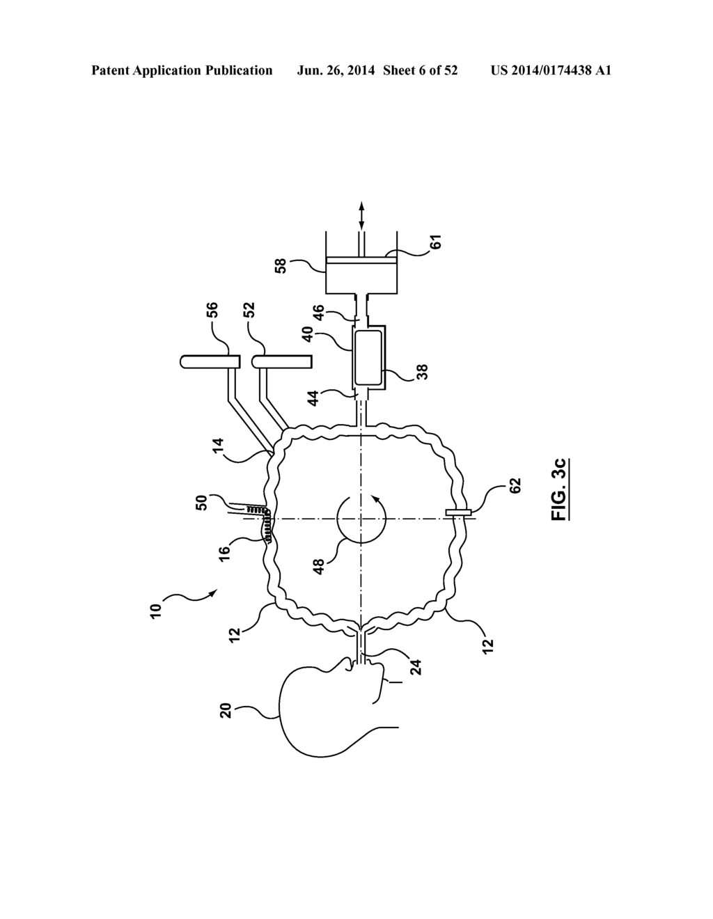 ANESTHETIC CIRCUIT HAVING A HOLLOW FIBER MEMBRANE - diagram, schematic, and image 07