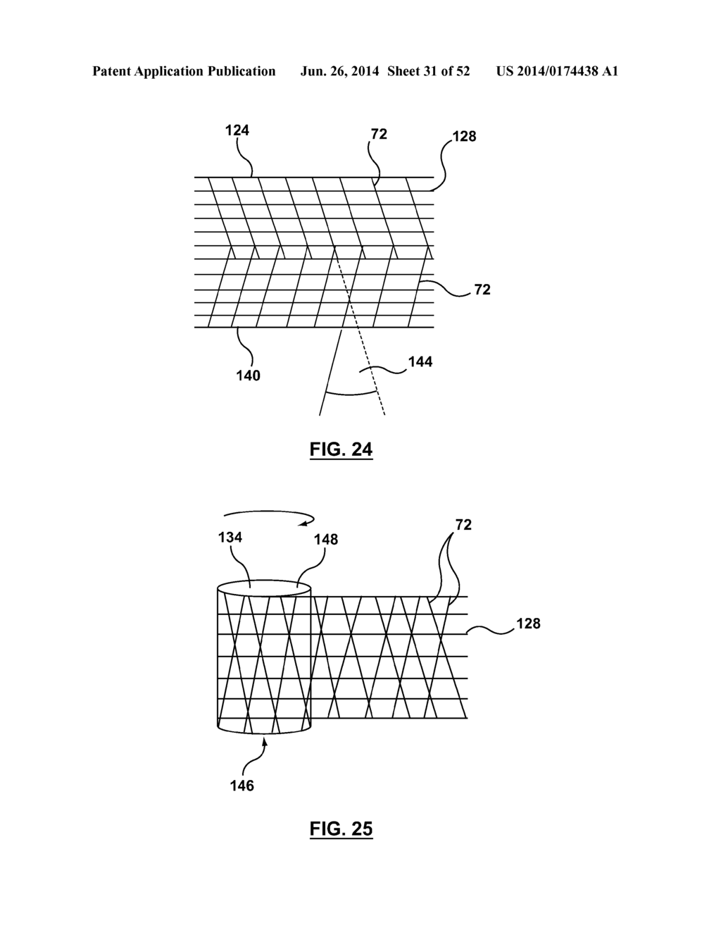 ANESTHETIC CIRCUIT HAVING A HOLLOW FIBER MEMBRANE - diagram, schematic, and image 32