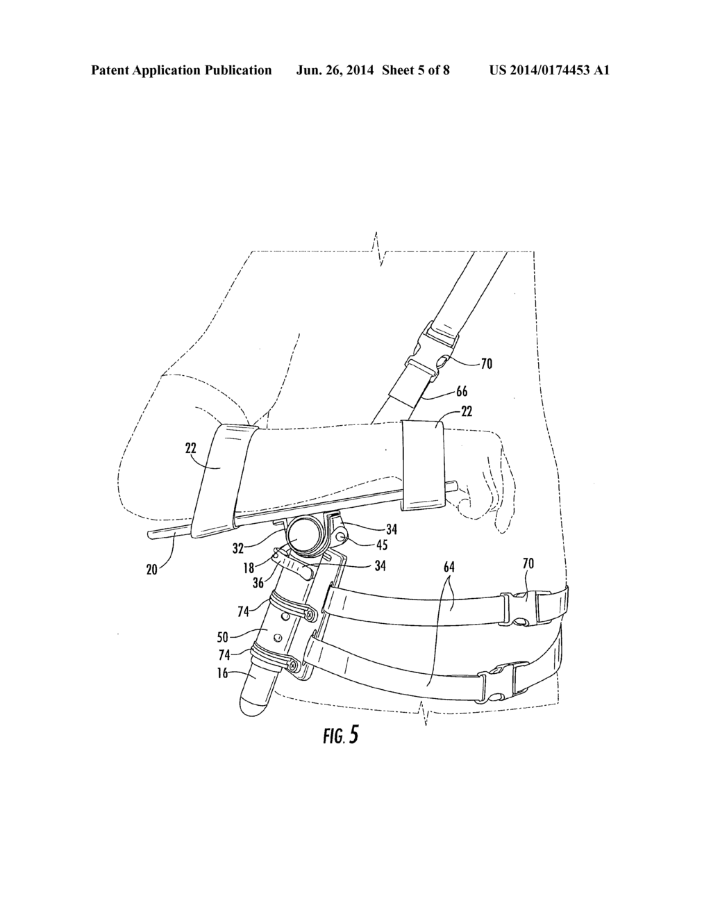 LATERAL LIMB SUPPORT DEVICE AND SYSTEM AND METHOD OF USING THE SAME - diagram, schematic, and image 06