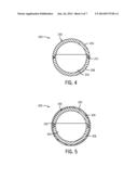 METHOD AND APPARATUS FOR A WELL EMPLOYING THE USE OF AN ACTIVATION BALL diagram and image