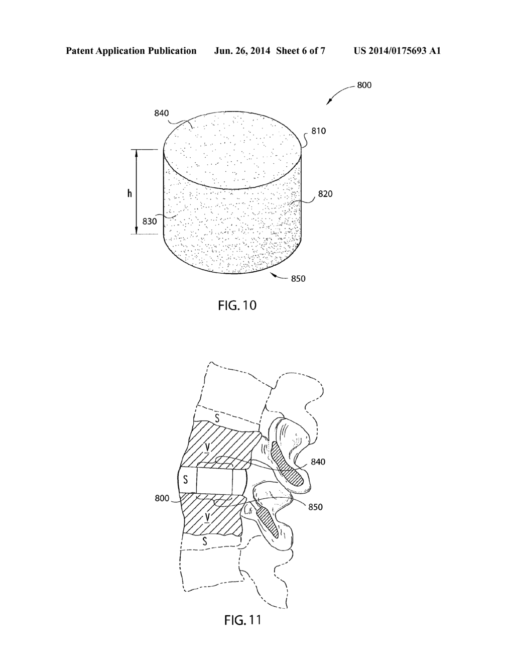 Method of Fabricating a Porous Orthopedic Implant - diagram, schematic, and image 07