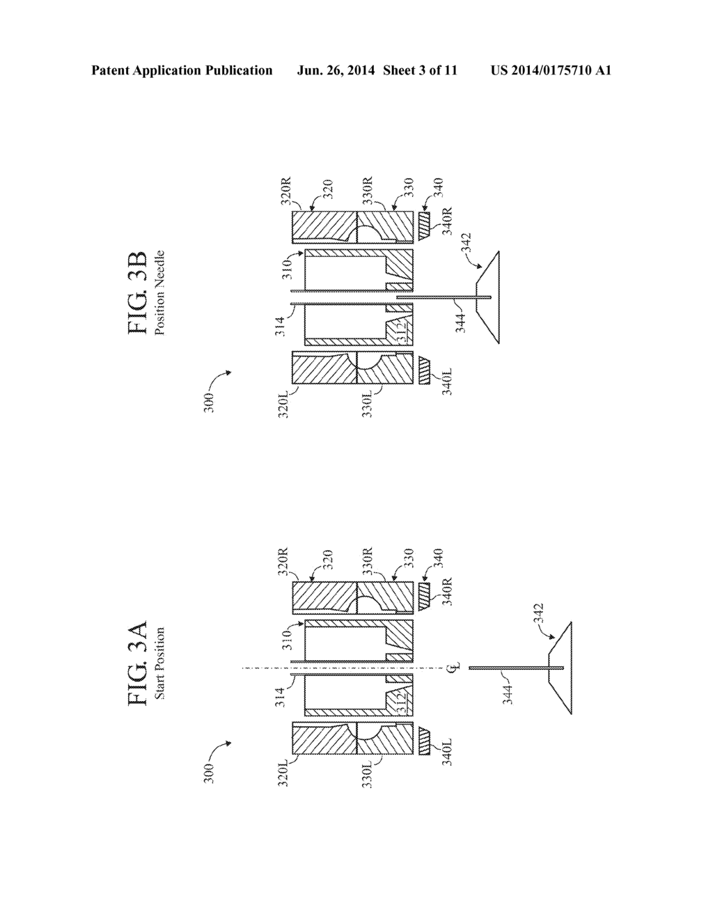 Blow Molding Techniques - diagram, schematic, and image 04