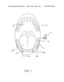 SYSTEMS AND METHODS FOR INTRA-ORAL BASED COMMUNICATIONS diagram and image