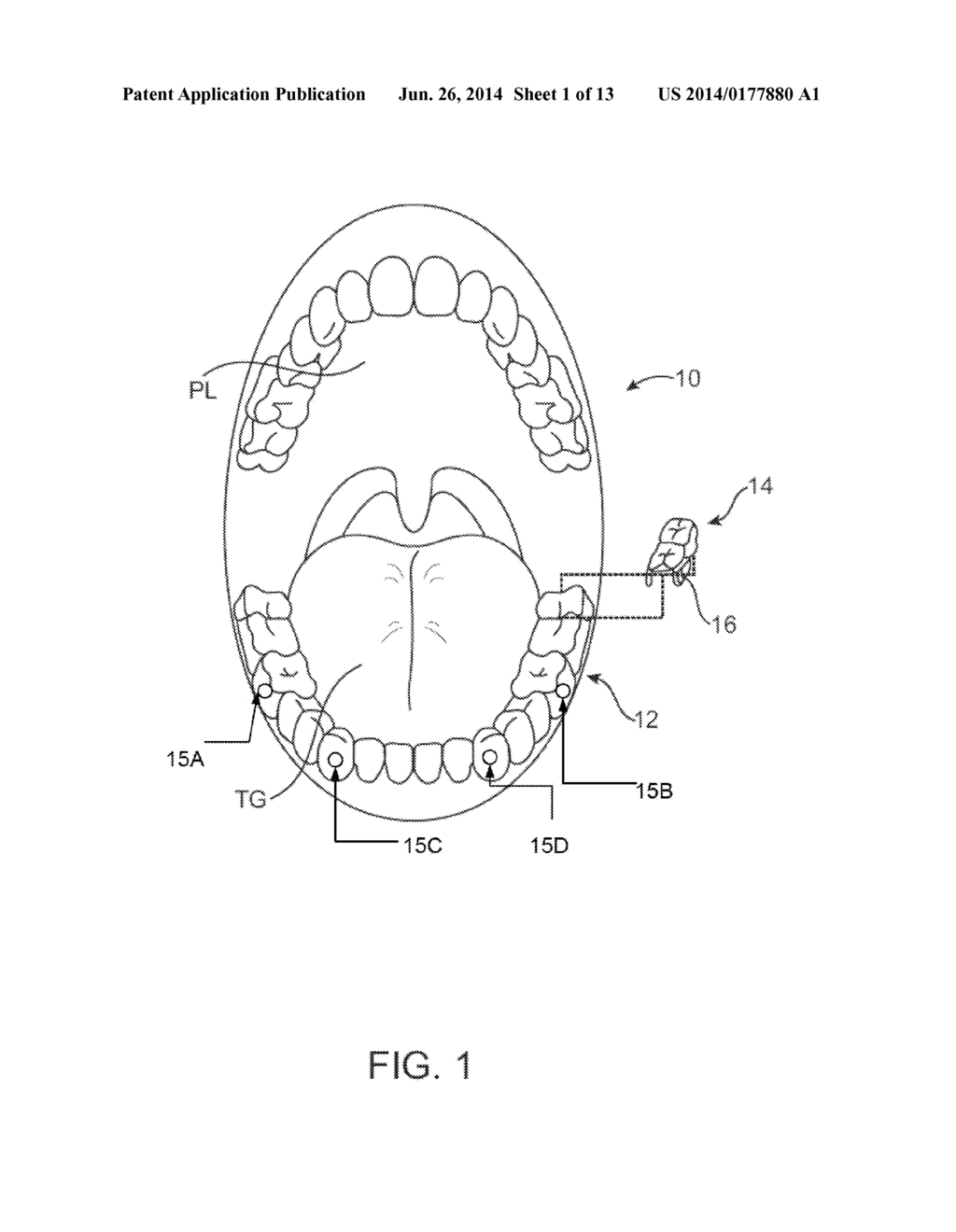 SYSTEMS AND METHODS FOR INTRA-ORAL BASED COMMUNICATIONS - diagram, schematic, and image 02