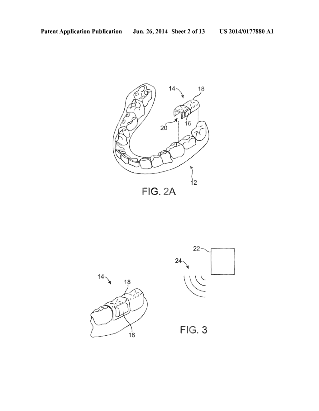 SYSTEMS AND METHODS FOR INTRA-ORAL BASED COMMUNICATIONS - diagram, schematic, and image 03