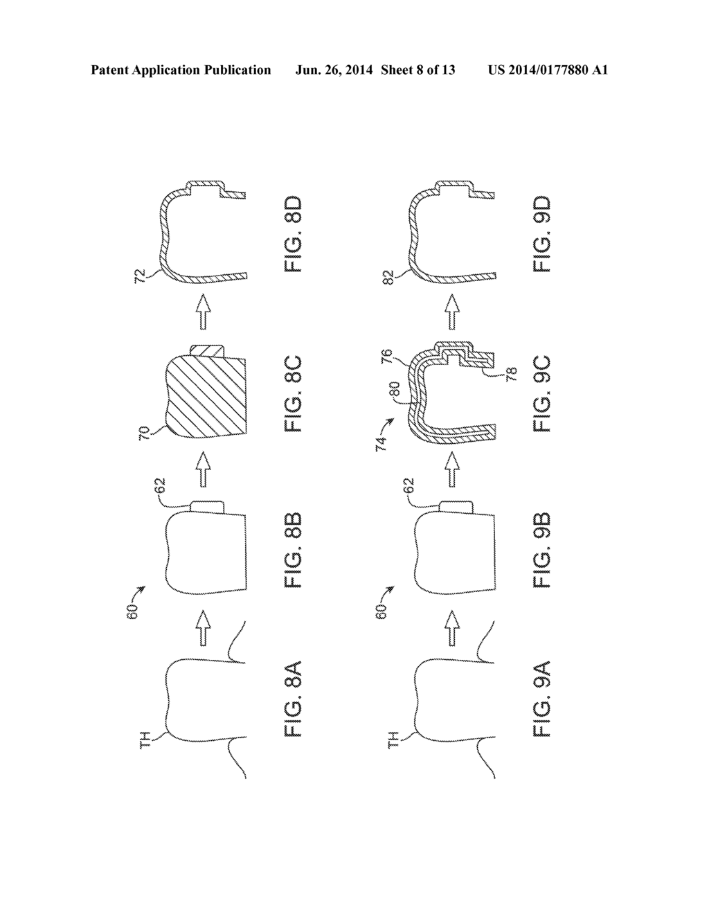 SYSTEMS AND METHODS FOR INTRA-ORAL BASED COMMUNICATIONS - diagram, schematic, and image 09