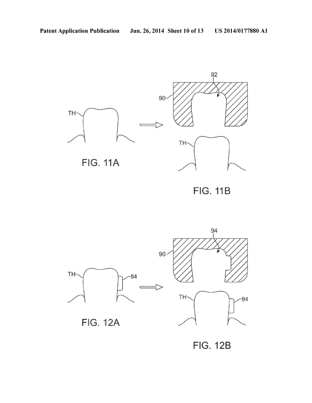 SYSTEMS AND METHODS FOR INTRA-ORAL BASED COMMUNICATIONS - diagram, schematic, and image 11