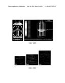 METHODS AND APPARATI FOR NONDESTRUCTIVE DETECTION OF UNDISSOLVED PARTICLES     IN A FLUID diagram and image