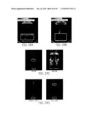 METHODS AND APPARATI FOR NONDESTRUCTIVE DETECTION OF UNDISSOLVED PARTICLES     IN A FLUID diagram and image