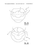 Pump, Pump System and Method for Pumping a Medium diagram and image