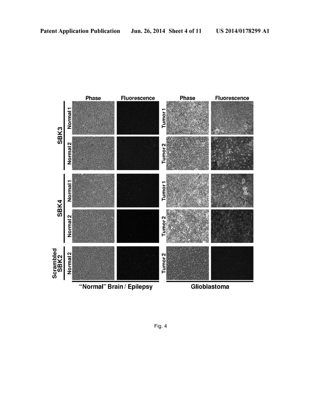 METHODS AND COMPOSITIONS FOR DETECTION OF CANCER - diagram, schematic, and image 05