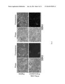 METHODS AND COMPOSITIONS FOR DETECTION OF CANCER diagram and image