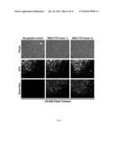 METHODS AND COMPOSITIONS FOR DETECTION OF CANCER diagram and image