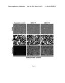 METHODS AND COMPOSITIONS FOR DETECTION OF CANCER diagram and image