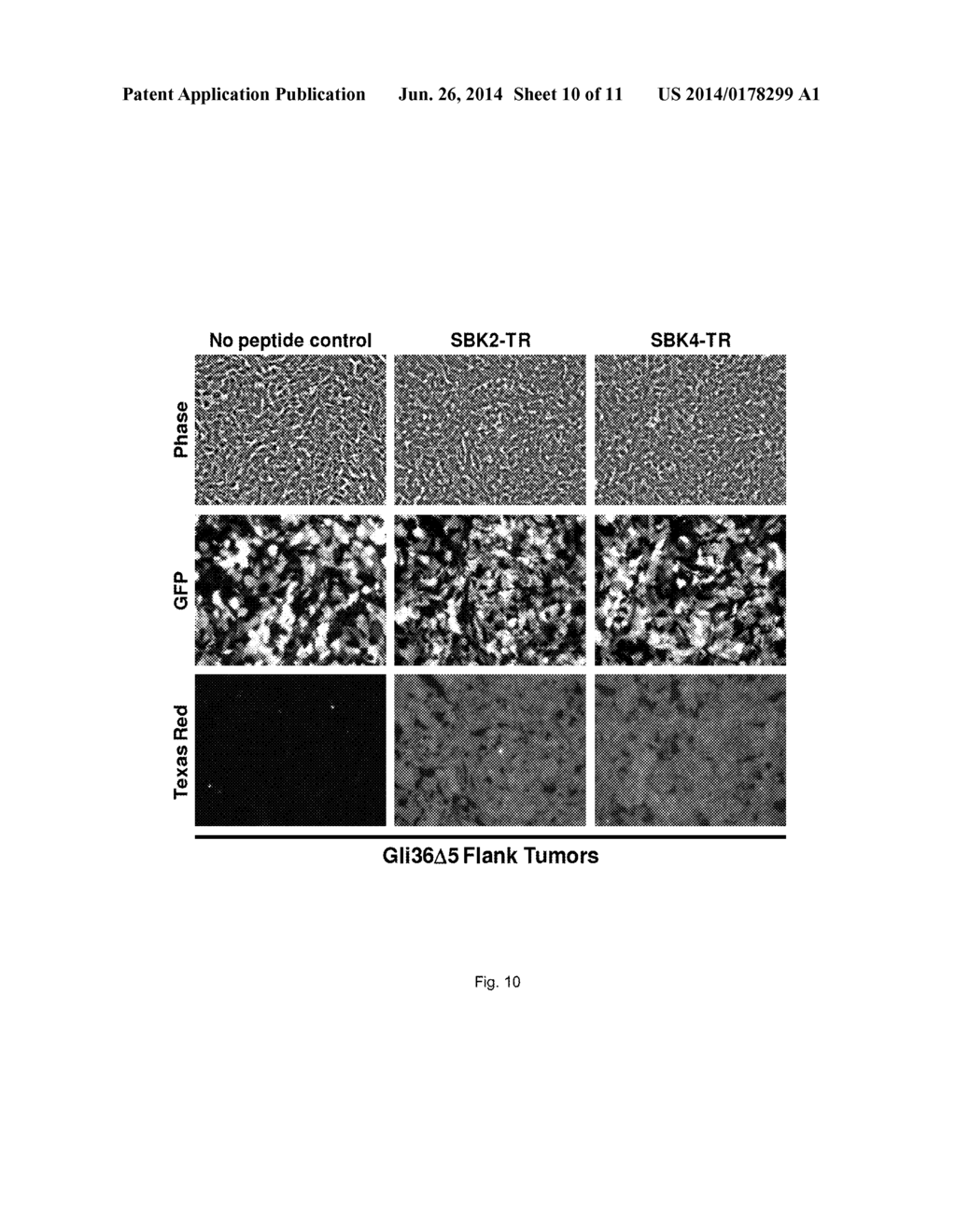 METHODS AND COMPOSITIONS FOR DETECTION OF CANCER - diagram, schematic, and image 11