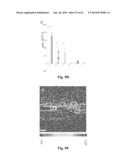 IDENTIFICATION AND USE OF ANXIOLYTIC COMPOUNDS diagram and image