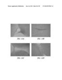 SUPPORTS AND METHODS FOR PROMOTING INTEGRATION OF CARTILAGE TISSUE     EXPLANTS diagram and image