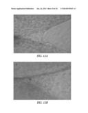 SUPPORTS AND METHODS FOR PROMOTING INTEGRATION OF CARTILAGE TISSUE     EXPLANTS diagram and image