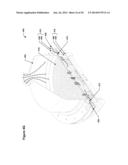 RADICAL SOURCE DESIGN FOR REMOTE PLASMA ATOMIC LAYER DEPOSITION diagram and image