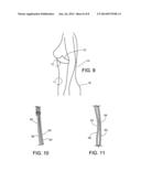 BODY-SHAPING INTIMACY GARMENT diagram and image