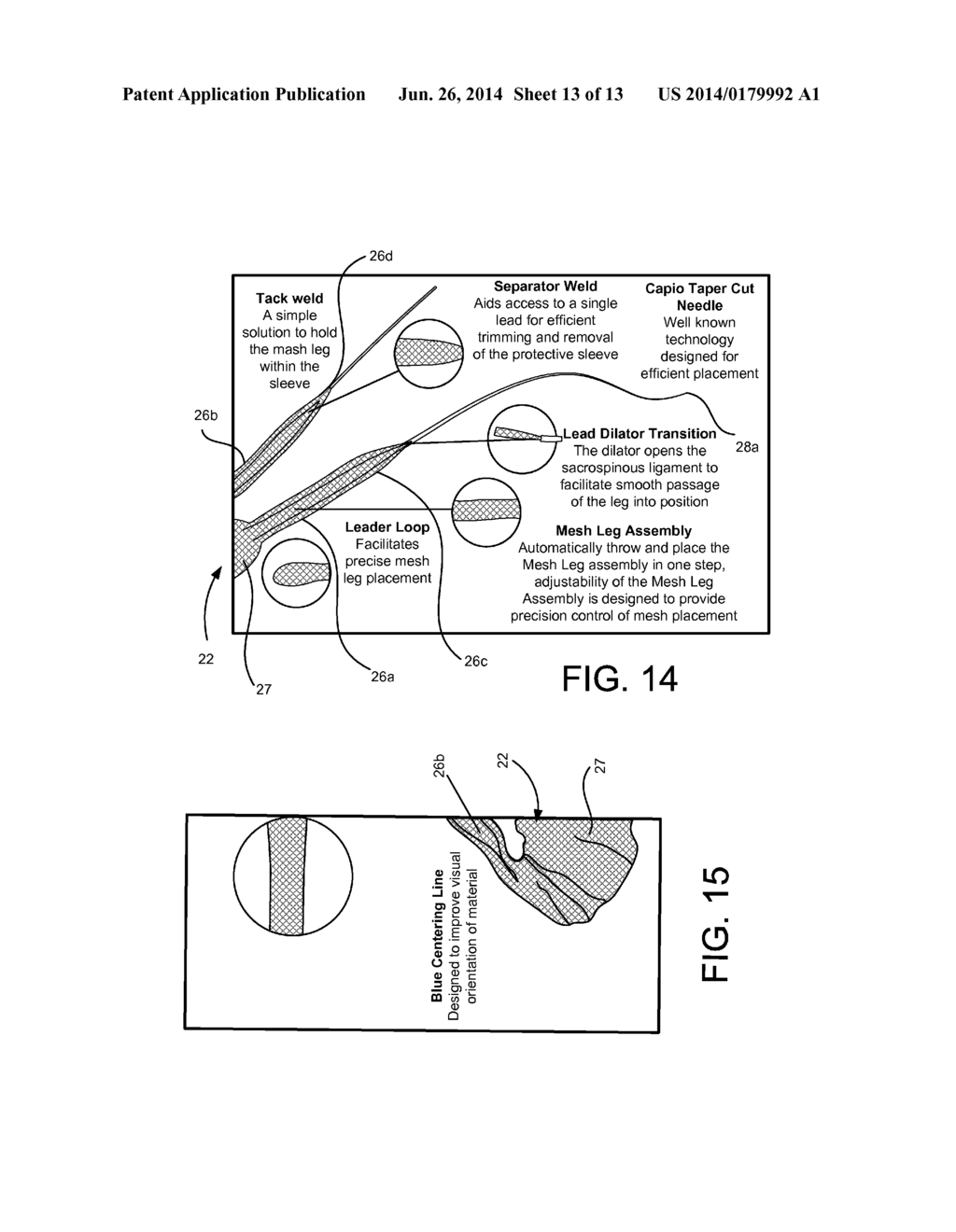 Apparatus For Treating Vaginal Prolapse - diagram, schematic, and image 14