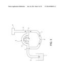 SYSTEM FOR DISTENDING BODY TISSUE CAVITIES BY CONTINUOUS FLOW IRRIGATION diagram and image