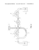 SYSTEM FOR DISTENDING BODY TISSUE CAVITIES BY CONTINUOUS FLOW IRRIGATION diagram and image