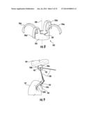 Tissue Retractor Assembly diagram and image