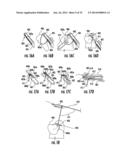 Tissue Retractor Assembly diagram and image