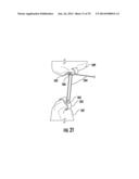 Tissue Retractor Assembly diagram and image