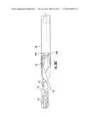 Tissue Retractor Assembly diagram and image