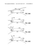 ADHESIVELY MOUNTED APPARATUS FOR DETERMINING PHYSIOLOGICAL AND CONTEXTUAL     STATUS diagram and image