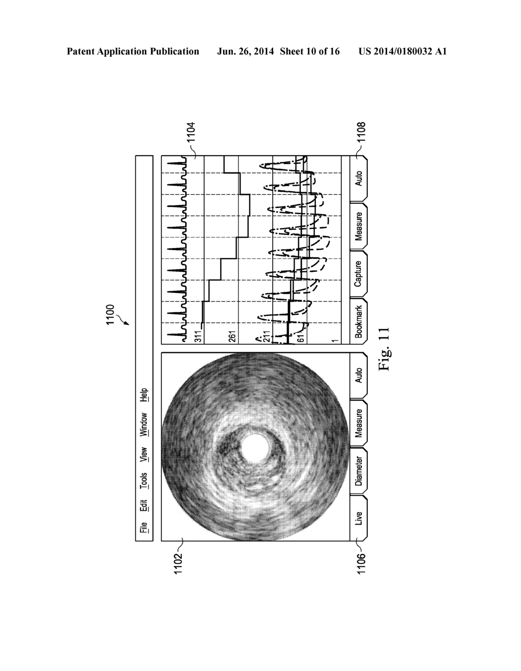 System and Method for Multi-Site Intravascular Measurement - diagram, schematic, and image 11