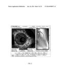 LOCATING INTRAVASCULAR IMAGES diagram and image