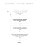 Apparatus and Method For Detecting Amyloid In A Retina in a Diagnosis,     Advancement, and Prognosing Of Alzheimer s disease, traumatic brain     injury, macular degeneration and a plurality of Neurodegenerative     dissorders, and Ocular Diseases diagram and image