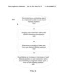 Apparatus and Method For Detecting Amyloid In A Retina in a Diagnosis,     Advancement, and Prognosing Of Alzheimer s disease, traumatic brain     injury, macular degeneration and a plurality of Neurodegenerative     dissorders, and Ocular Diseases diagram and image