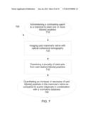 Apparatus and Method For Detecting Amyloid In A Retina in a Diagnosis,     Advancement, and Prognosing Of Alzheimer s disease, traumatic brain     injury, macular degeneration and a plurality of Neurodegenerative     dissorders, and Ocular Diseases diagram and image