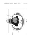 Renal Injury Inhibiting Devices, Systems, and Methods Employing     Low-Frequency Ultrasound or Other Cyclical Pressure Energies diagram and image