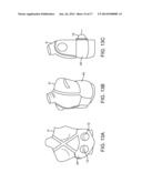 Renal Injury Inhibiting Devices, Systems, and Methods Employing     Low-Frequency Ultrasound or Other Cyclical Pressure Energies diagram and image