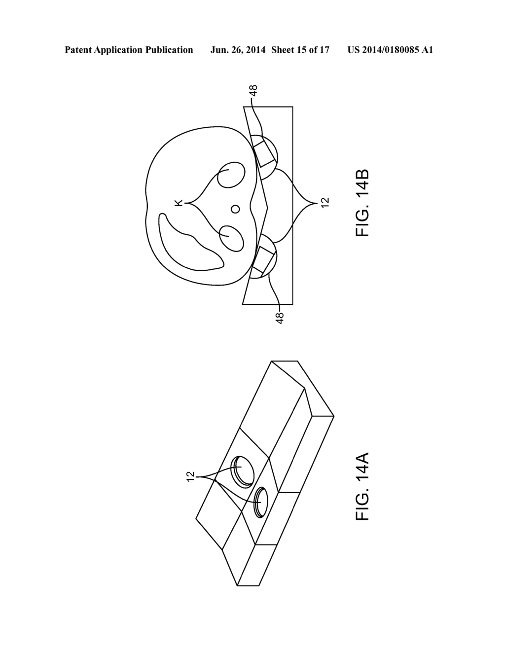 Renal Injury Inhibiting Devices, Systems, and Methods Employing     Low-Frequency Ultrasound or Other Cyclical Pressure Energies - diagram, schematic, and image 16